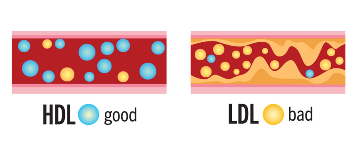 cholesterol