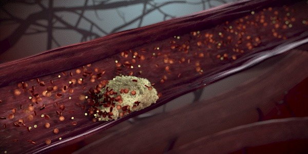 GIF of artist rendering of cholesterol in blood stream