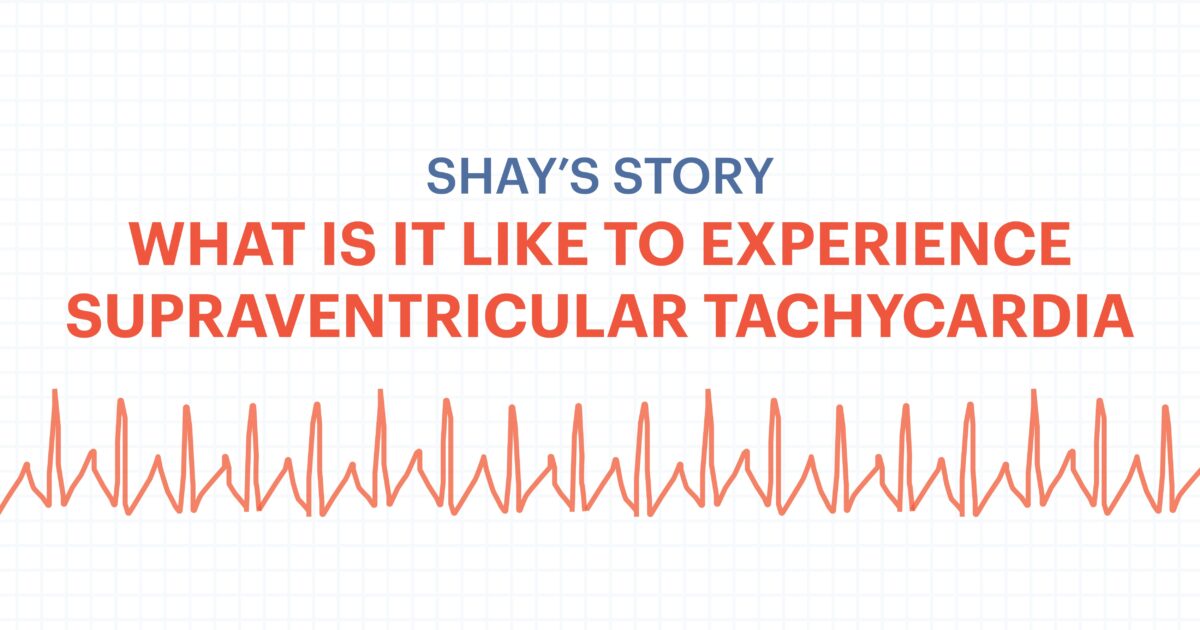 SVT ECG read out, text on graphic: Shay's Story What It's Like to Experience Supraventricular Tachycardia?